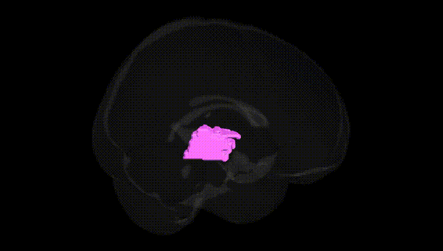 Full Brain Black