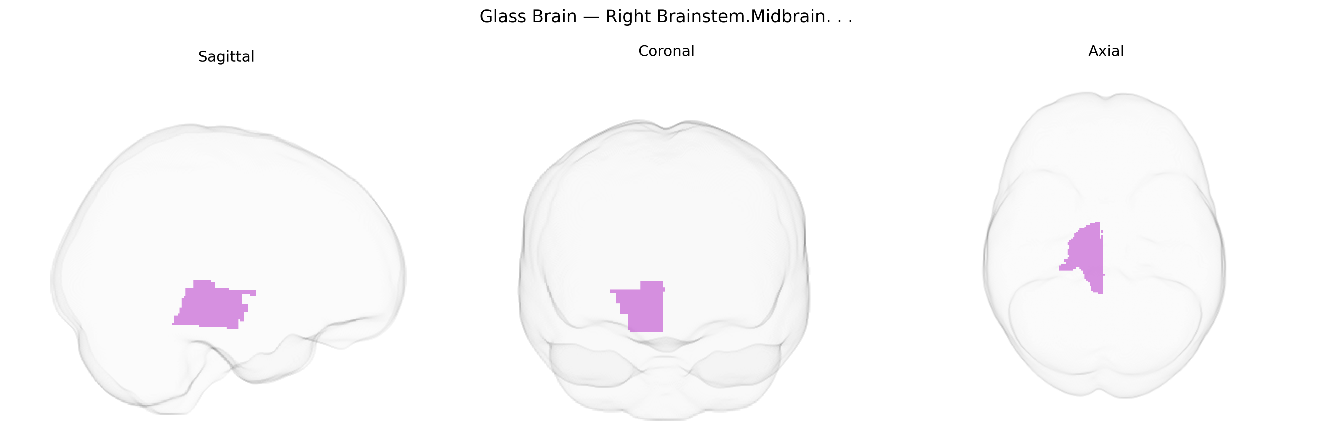 Triplanar Ghost Brain