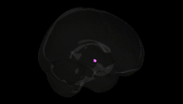 Full Brain Black