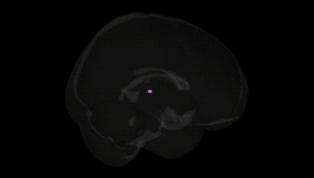 Full Brain Black