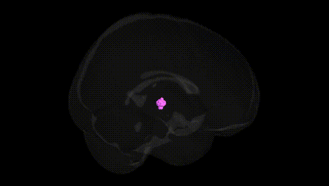 Full Brain Black