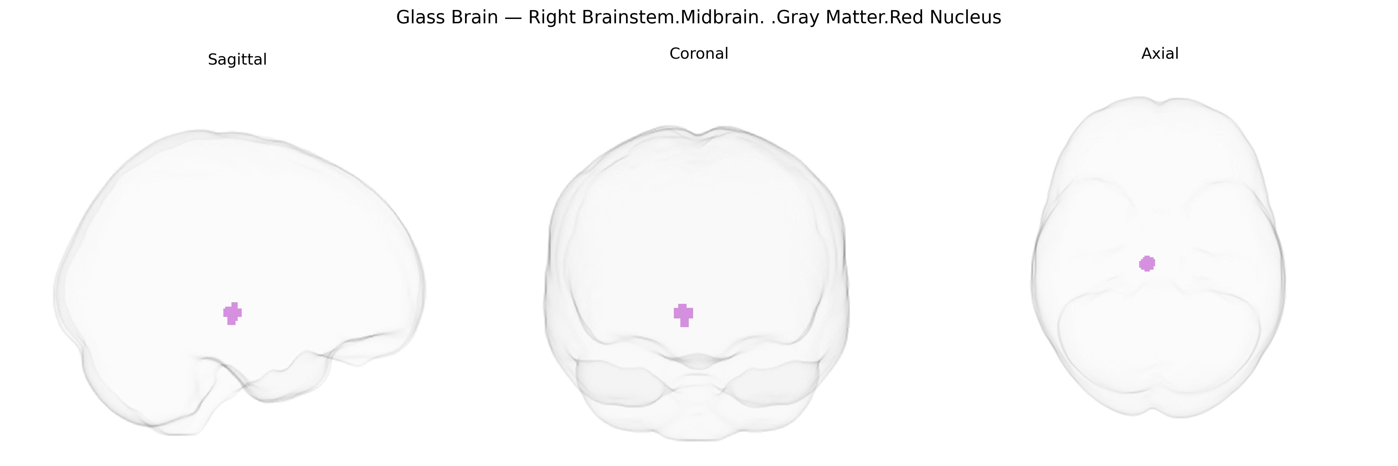 Triplanar Ghost Brain