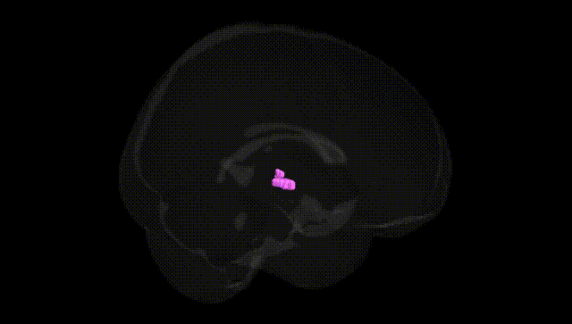 Full Brain Black
