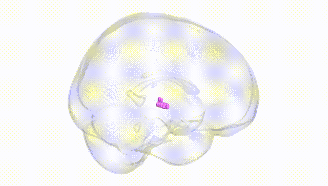 Full Brain White