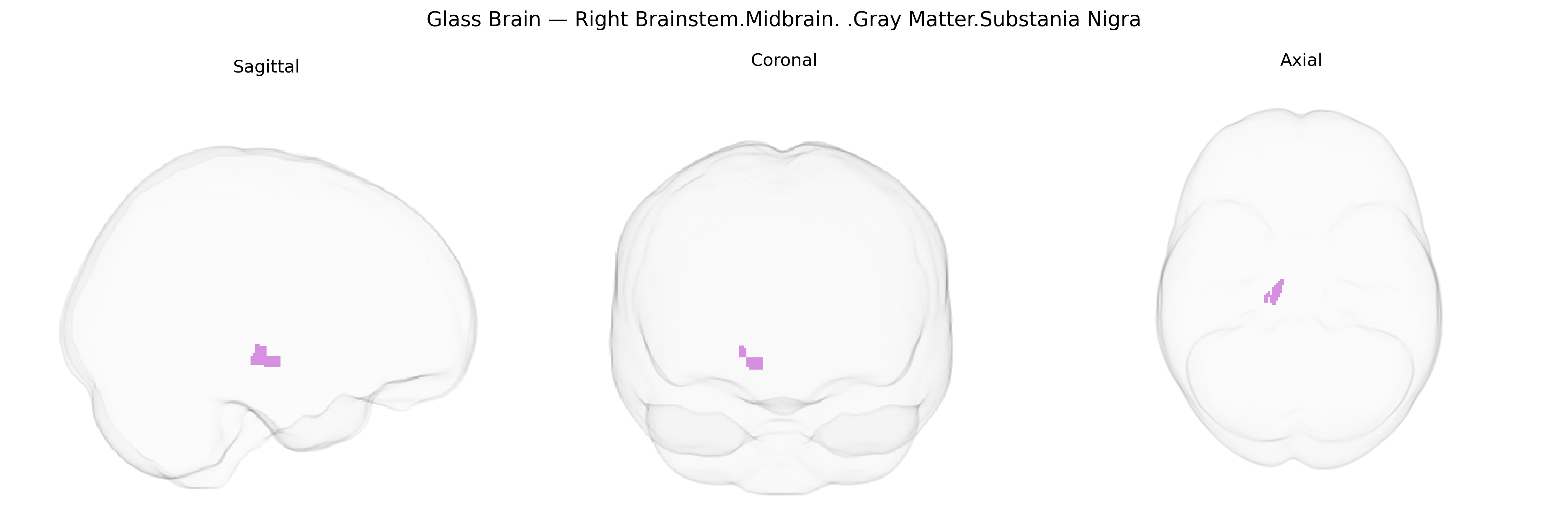 Triplanar Ghost Brain