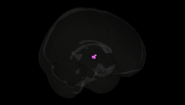 Full Brain Black
