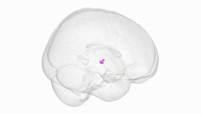 Full Brain White