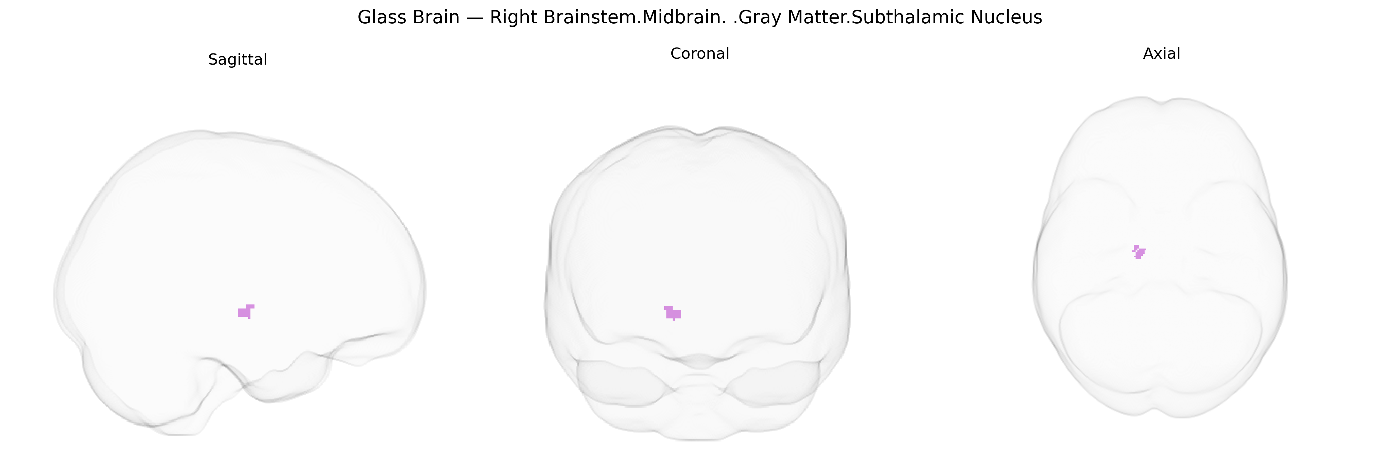 Triplanar Ghost Brain