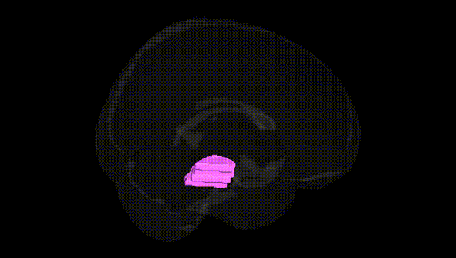 Full Brain Black