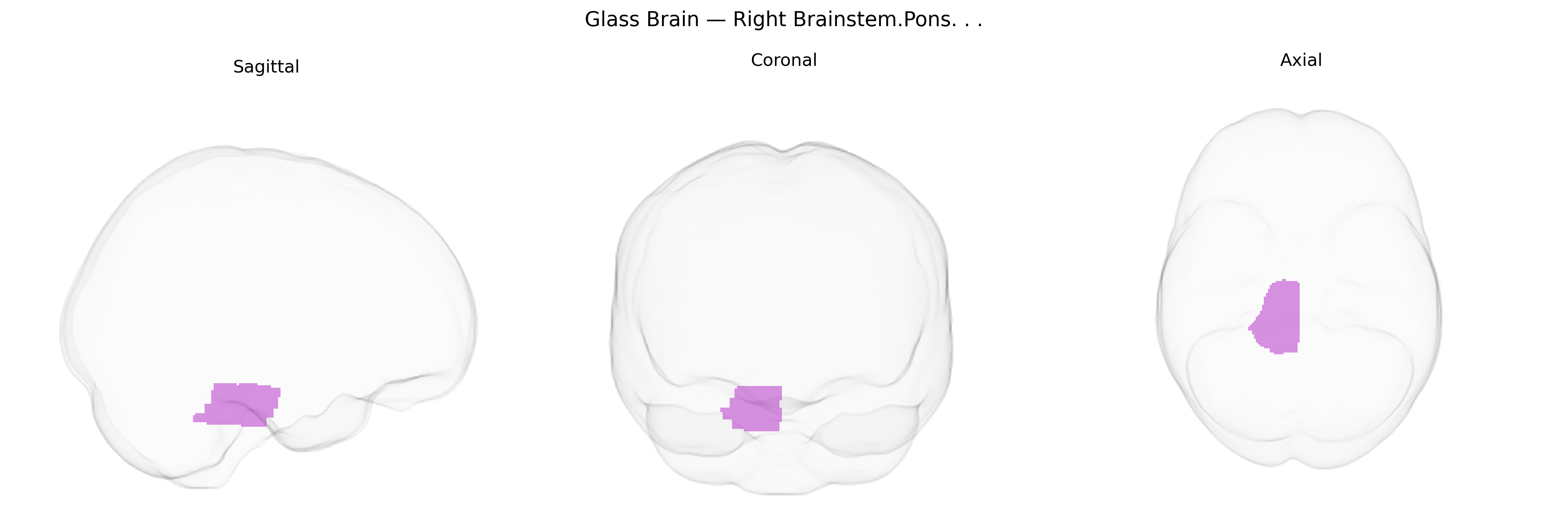 Triplanar Ghost Brain