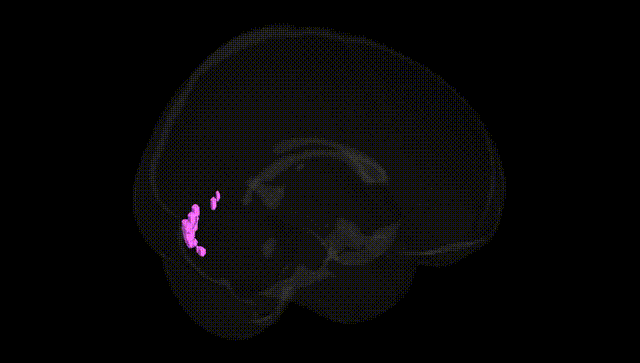Full Brain Black