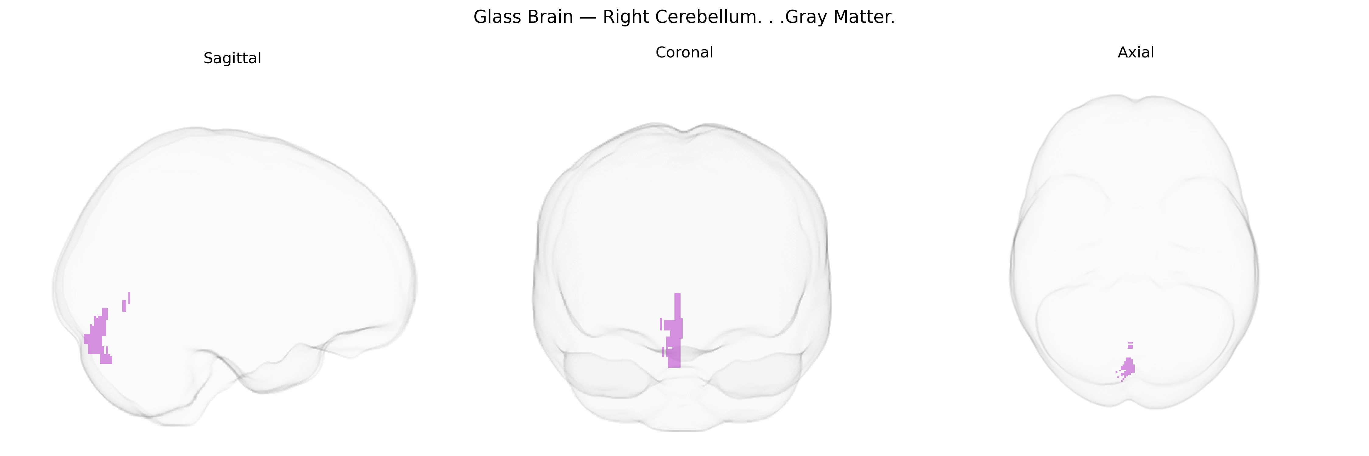 Triplanar Ghost Brain
