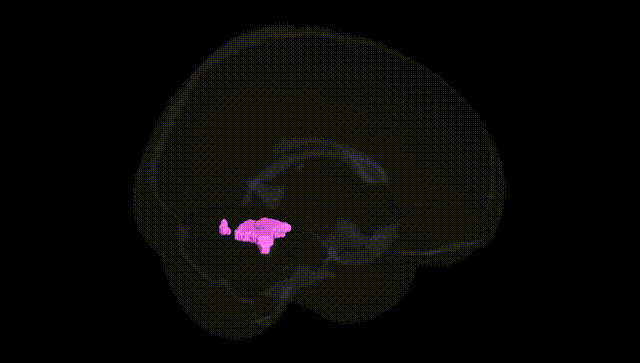 Full Brain Black