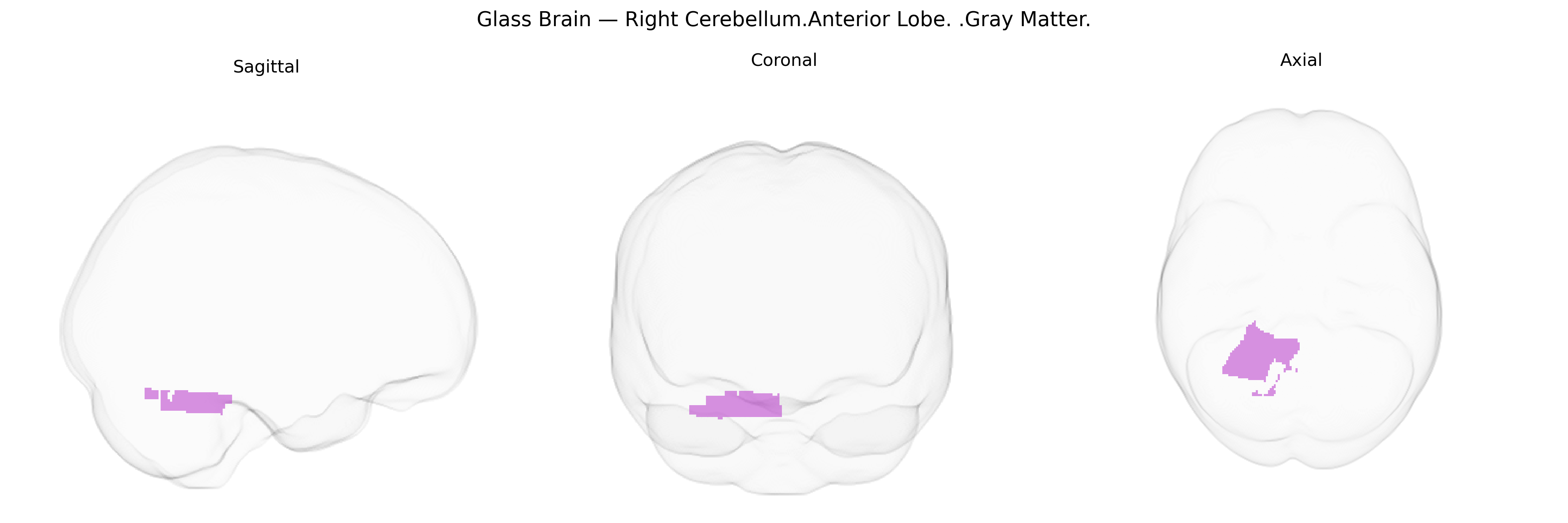 Triplanar Ghost Brain