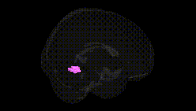 Full Brain Black