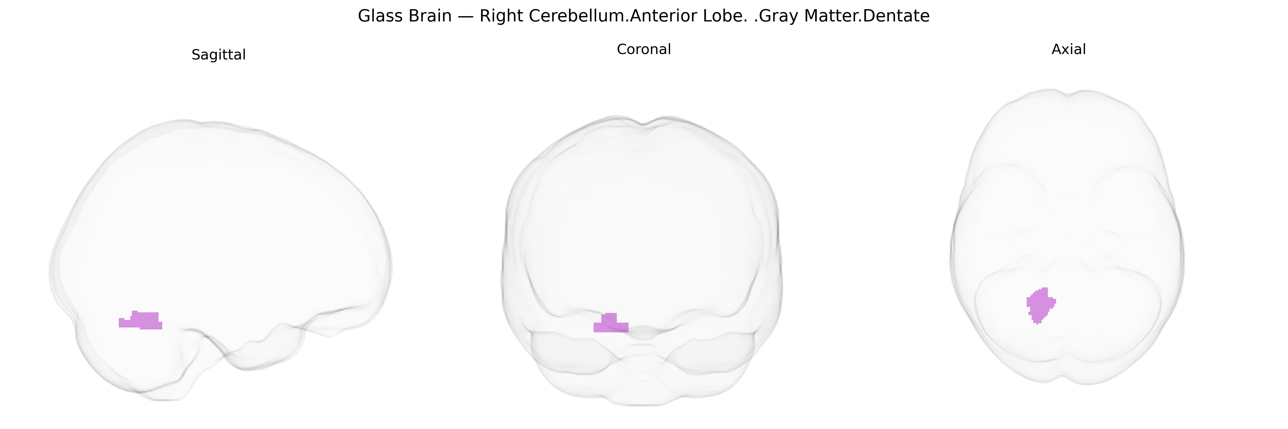 Triplanar Ghost Brain