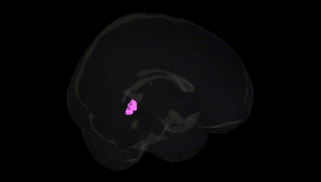 Full Brain Black