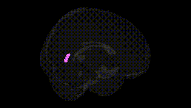 Full Brain Black