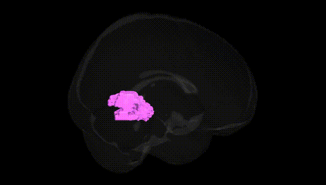 Full Brain Black