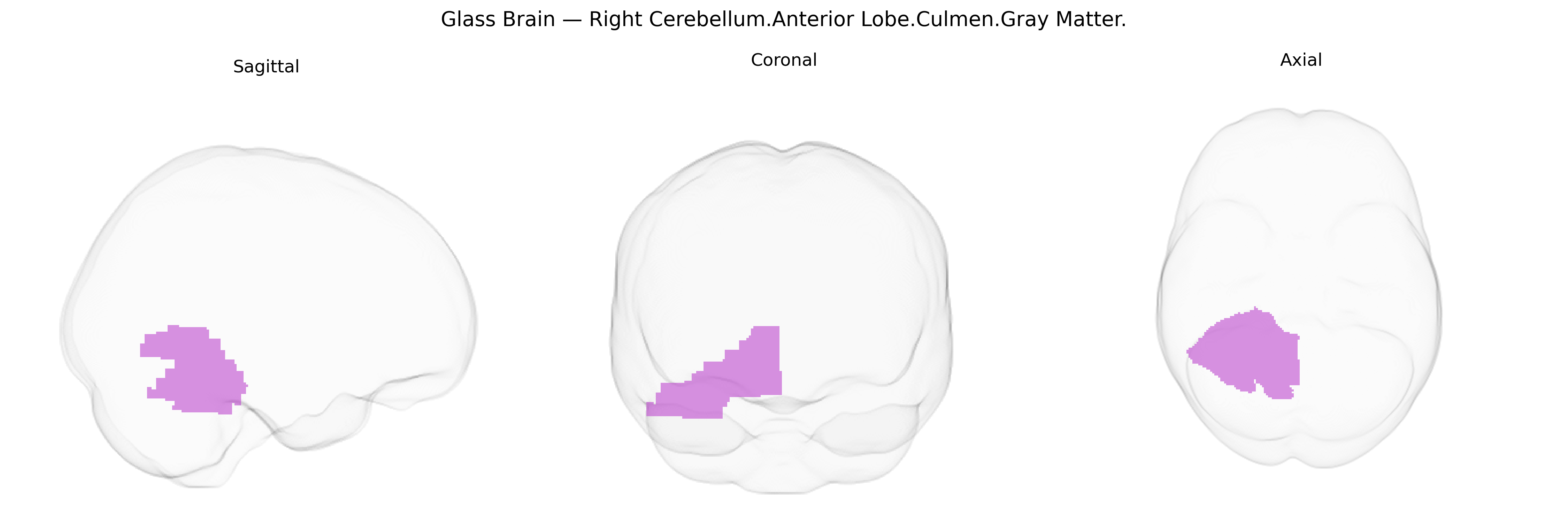 Triplanar Ghost Brain