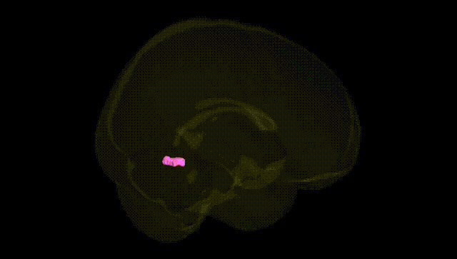 Full Brain Black