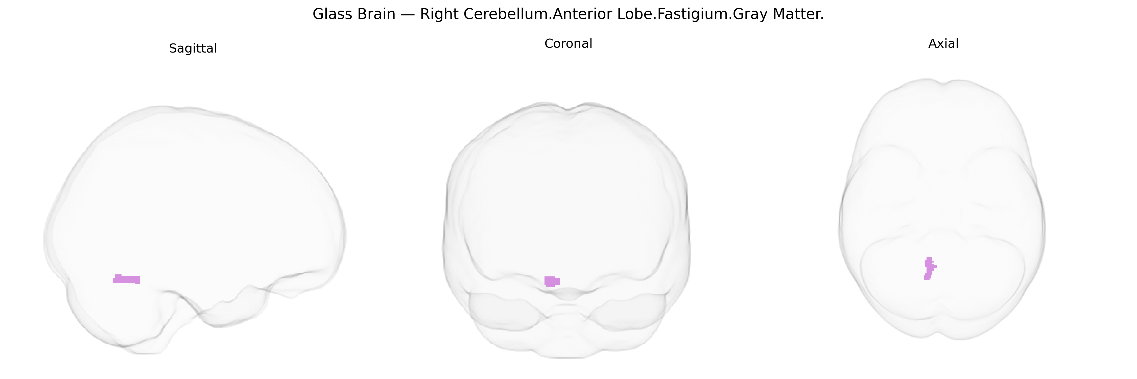 Triplanar Ghost Brain