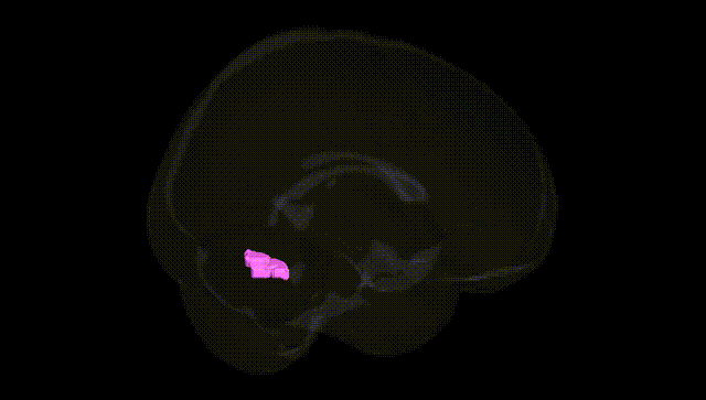 Full Brain Black