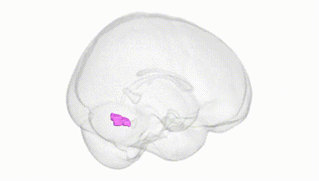 Full Brain White