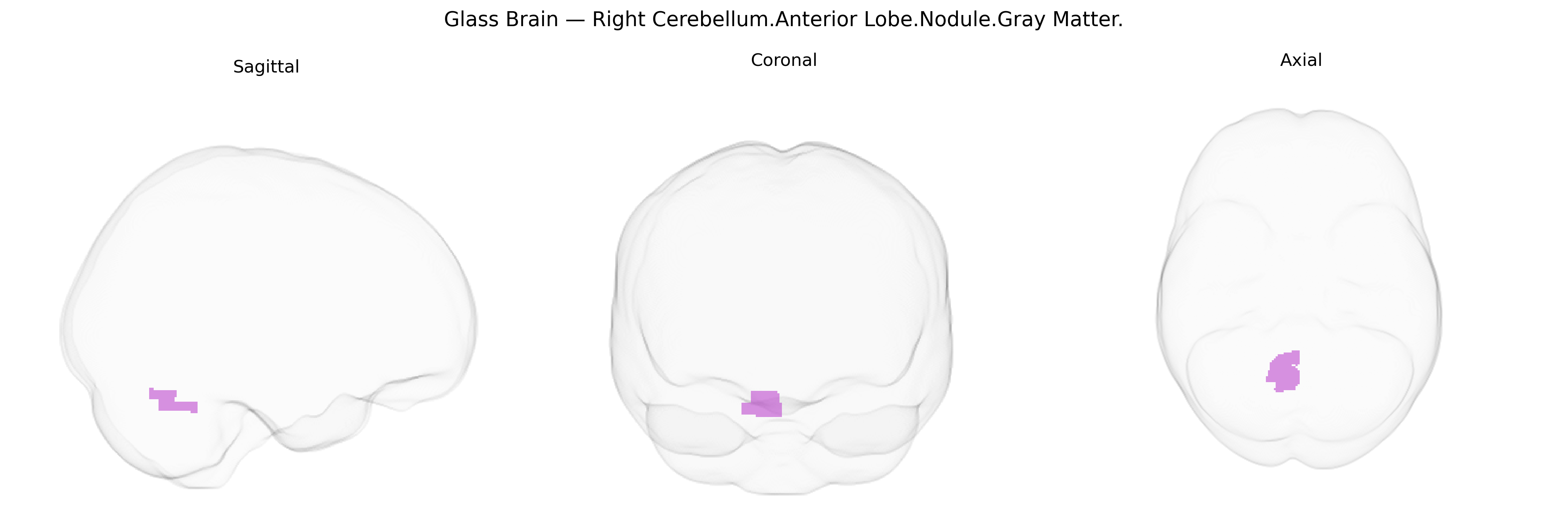Triplanar Ghost Brain
