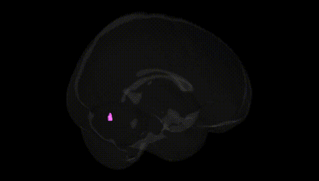 Full Brain Black