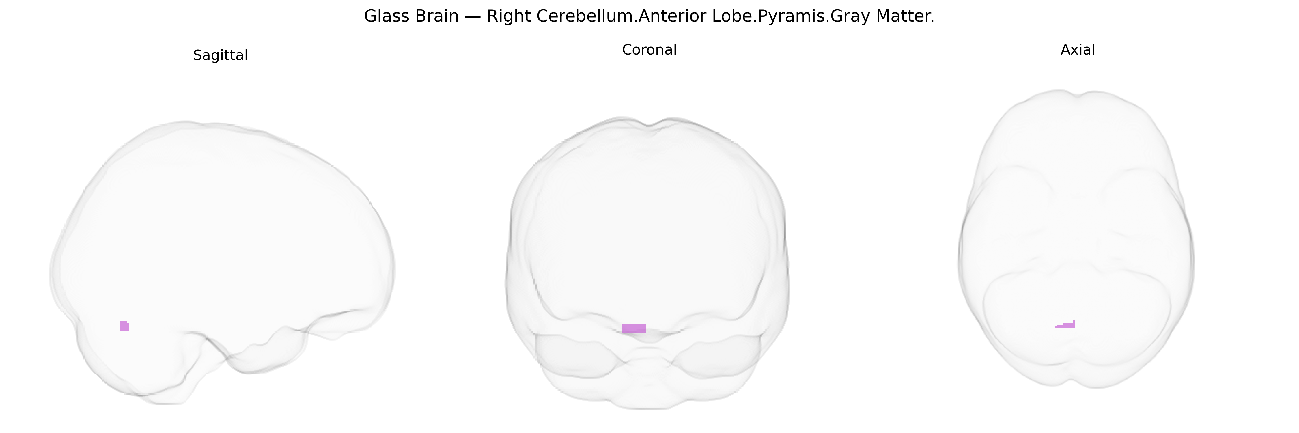 Triplanar Ghost Brain