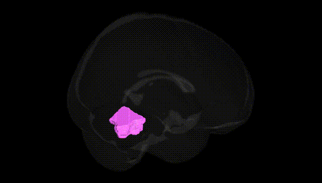 Full Brain Black