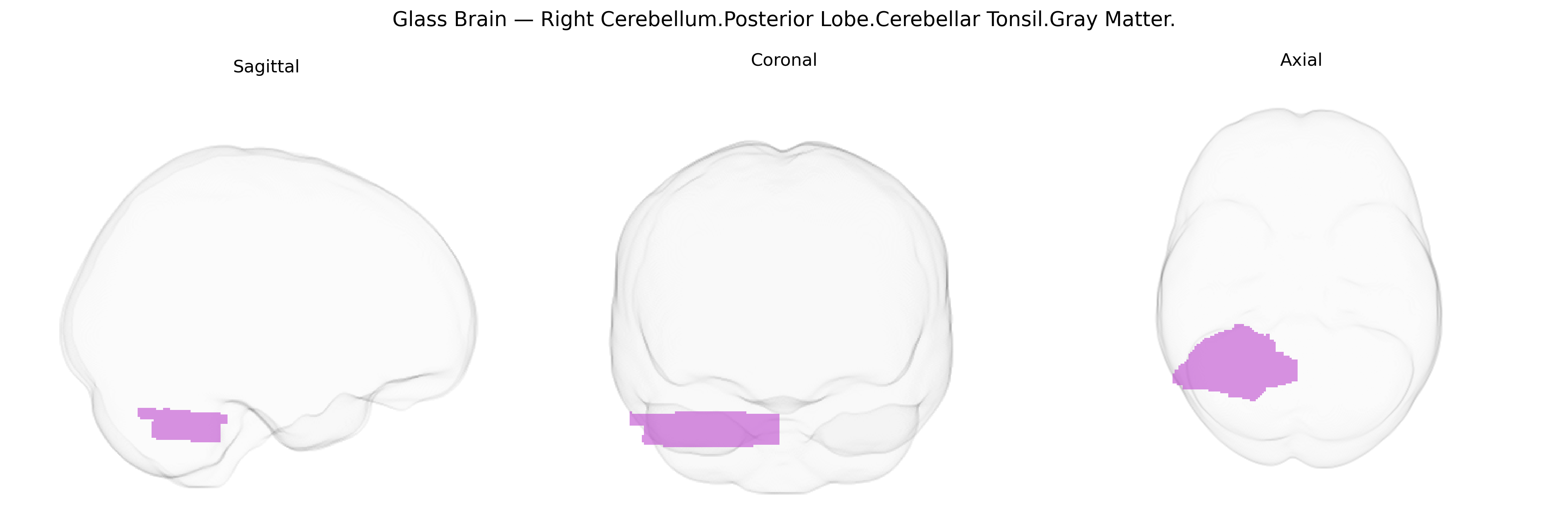 Triplanar Ghost Brain