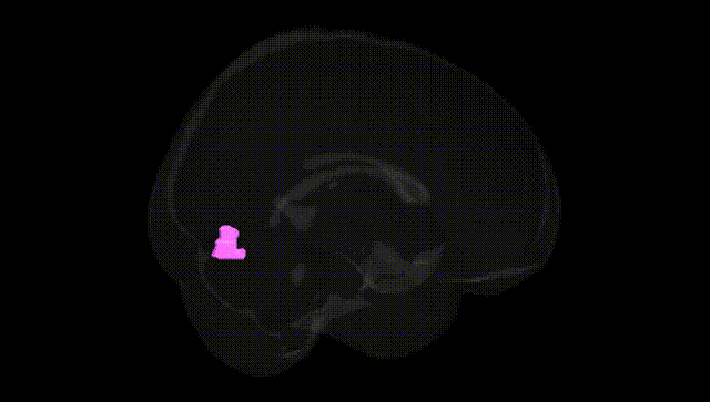 Full Brain Black
