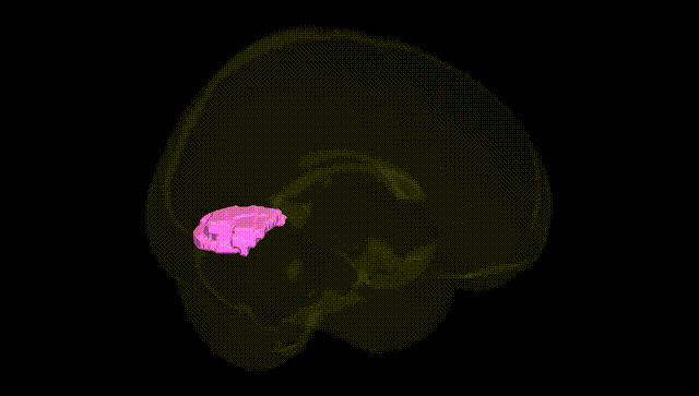 Full Brain Black