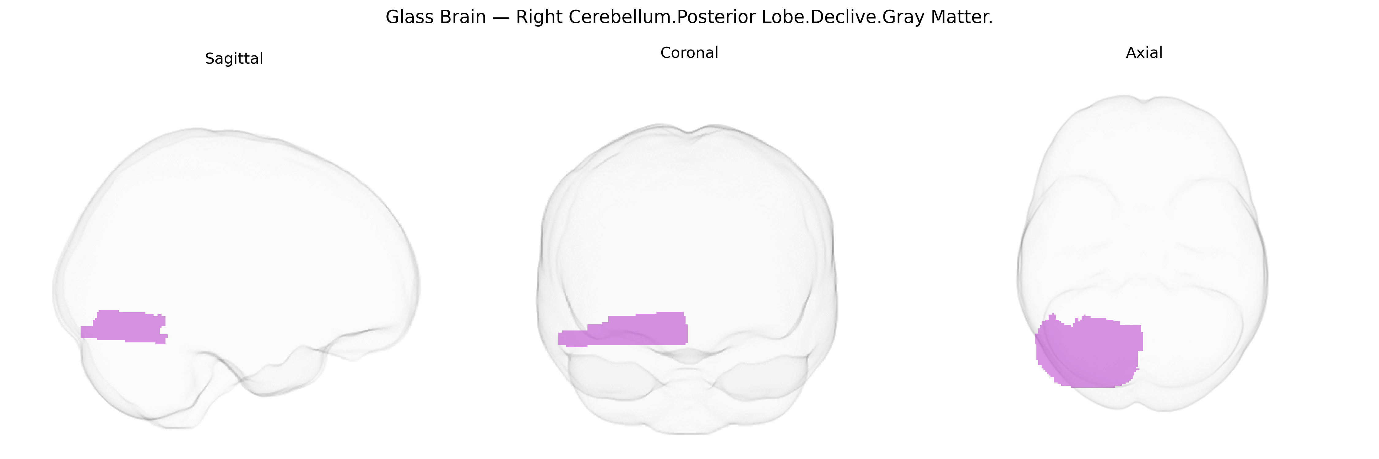 Triplanar Ghost Brain