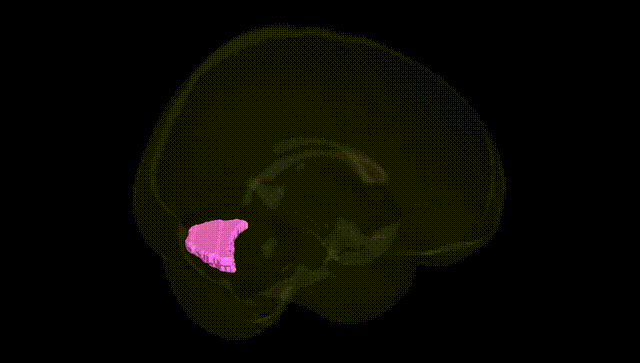 Full Brain Black
