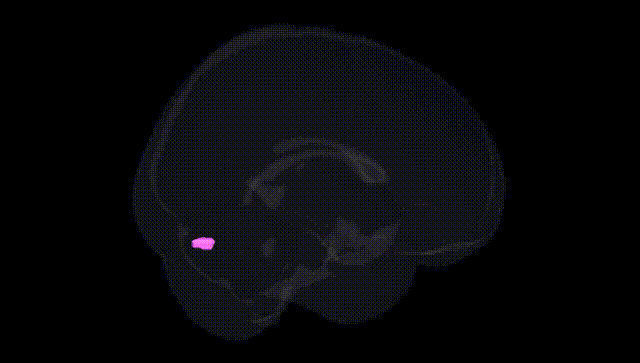 Full Brain Black