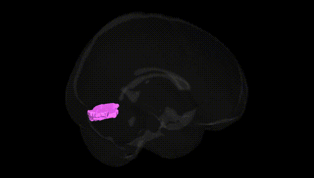Full Brain Black