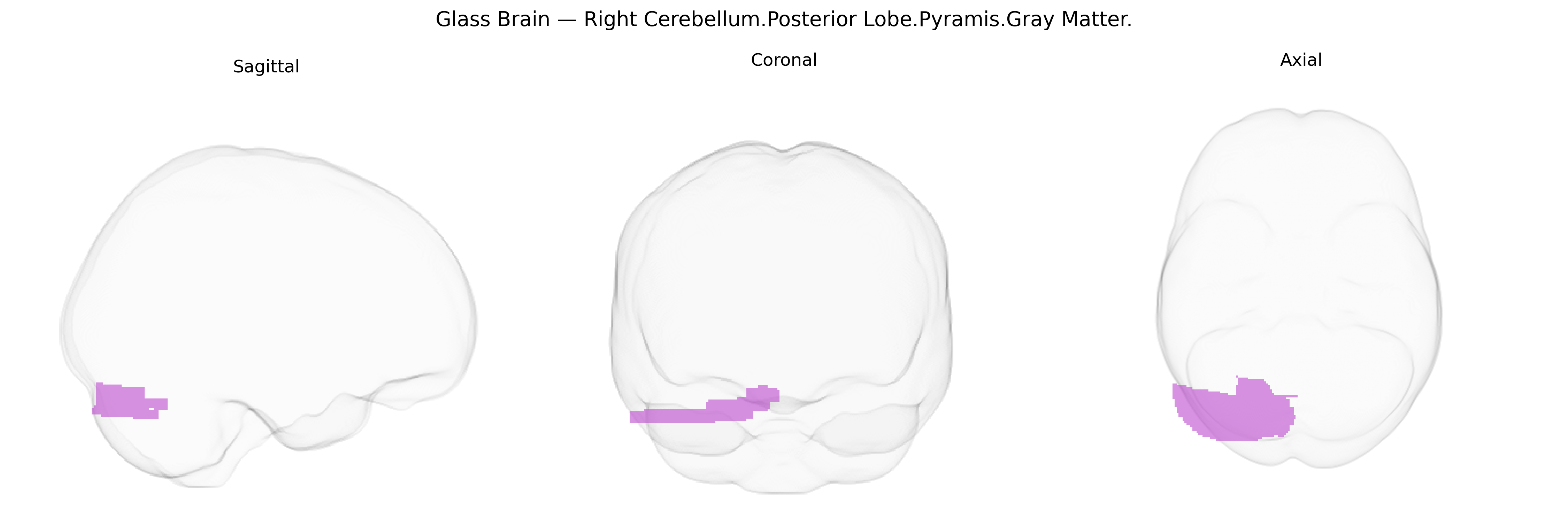 Triplanar Ghost Brain