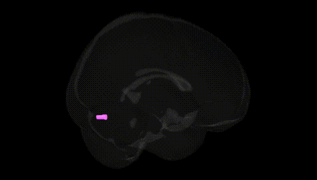 Full Brain Black