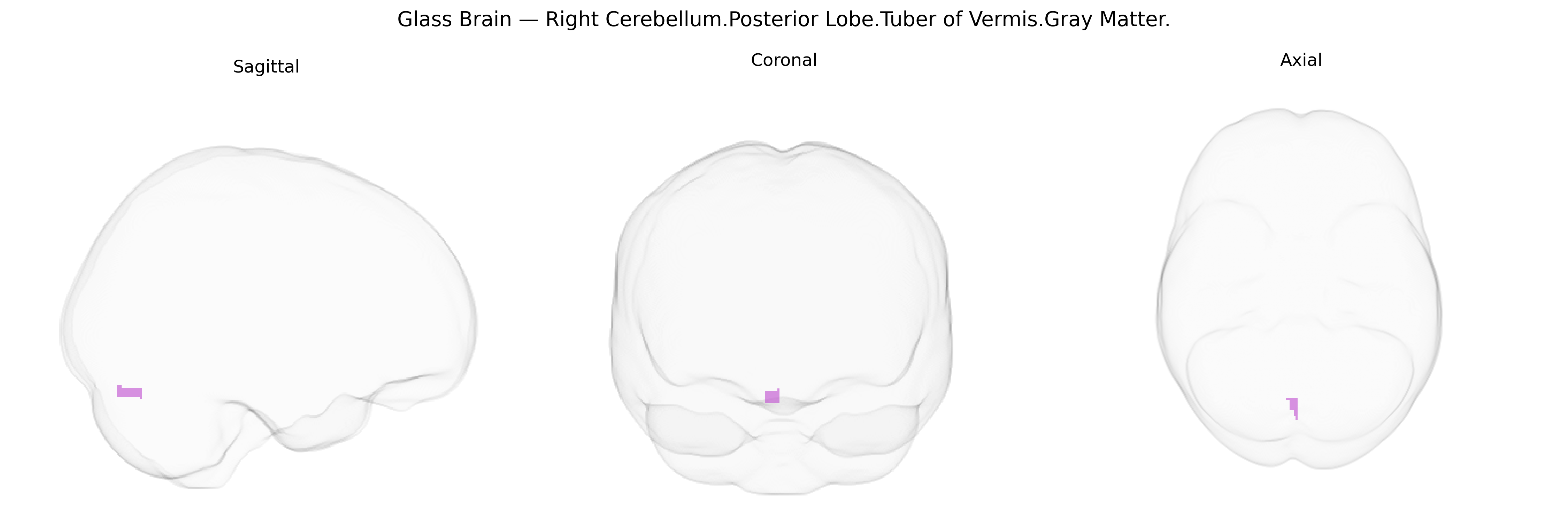 Triplanar Ghost Brain