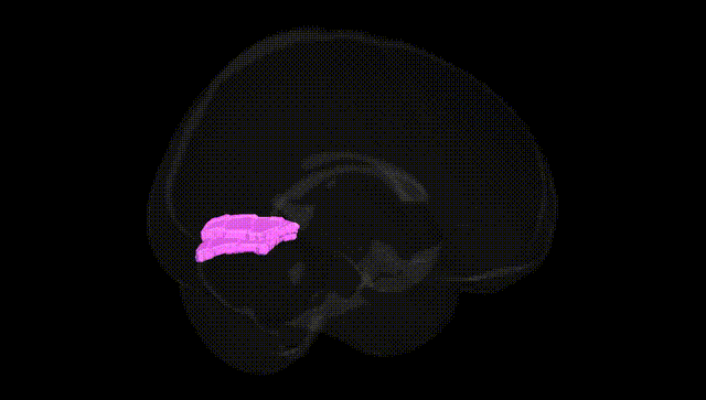 Full Brain Black