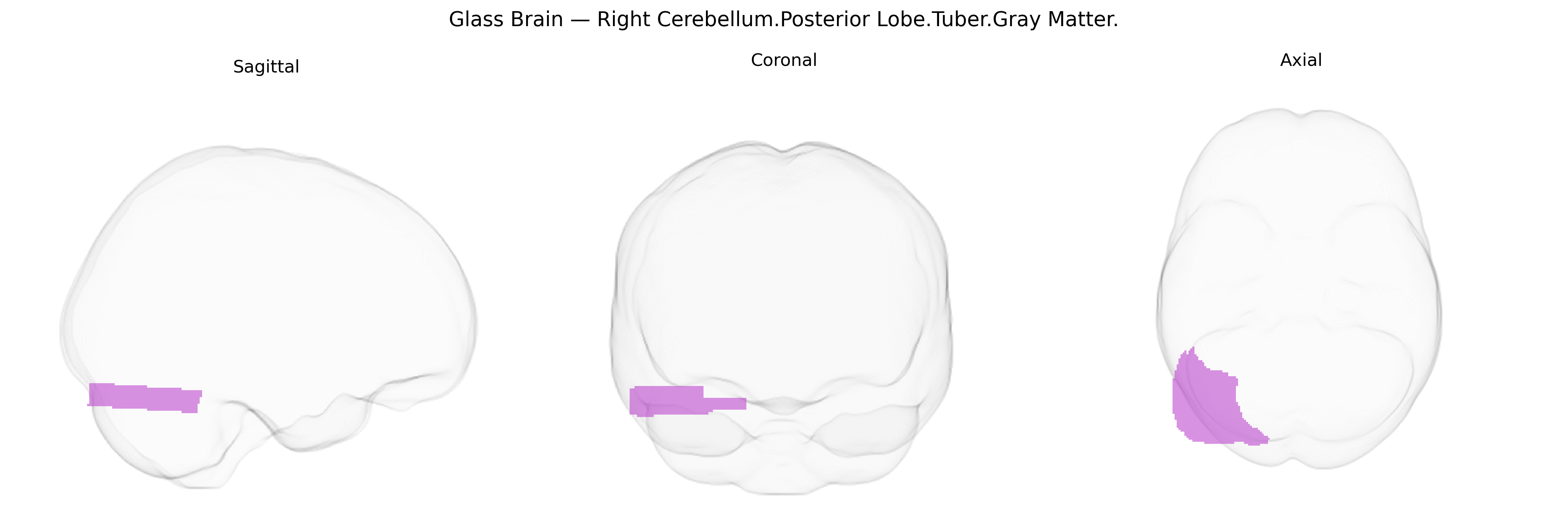 Triplanar Ghost Brain