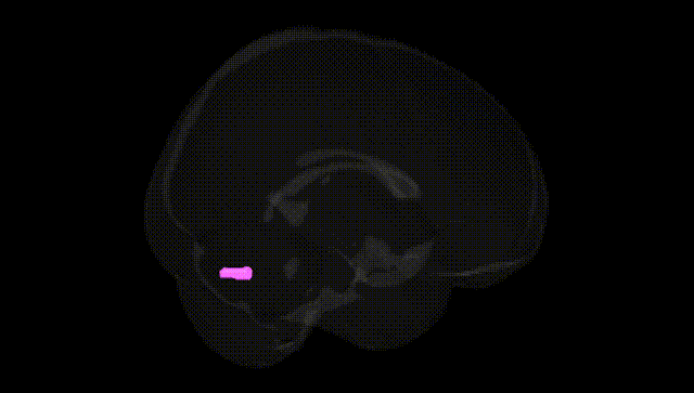 Full Brain Black