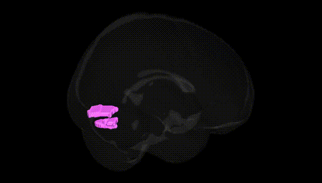 Full Brain Black