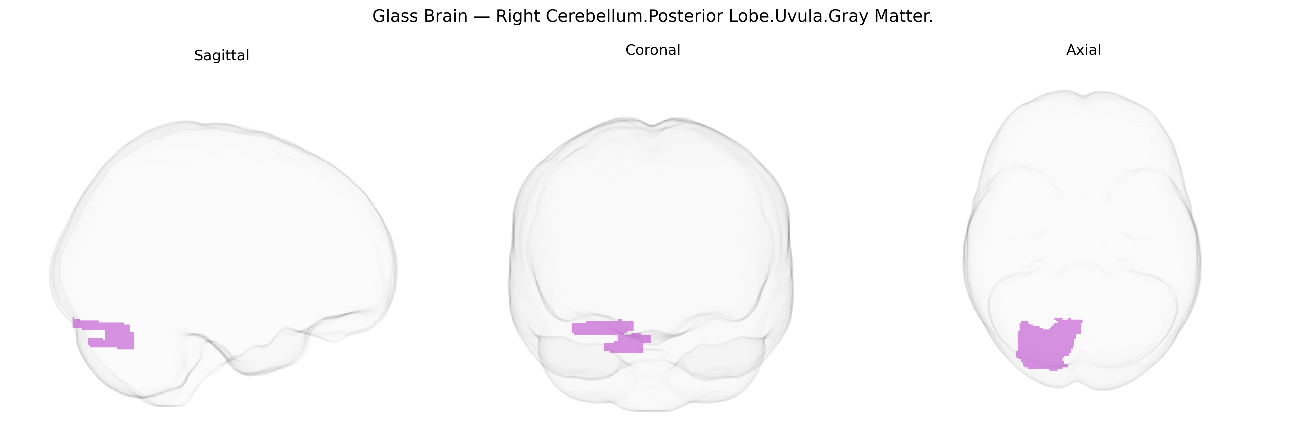 Triplanar Ghost Brain