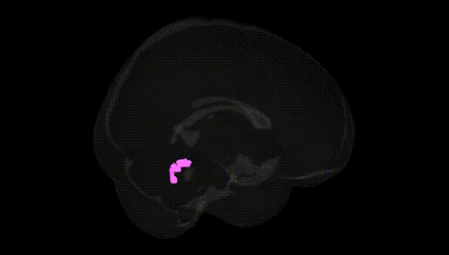 Full Brain Black