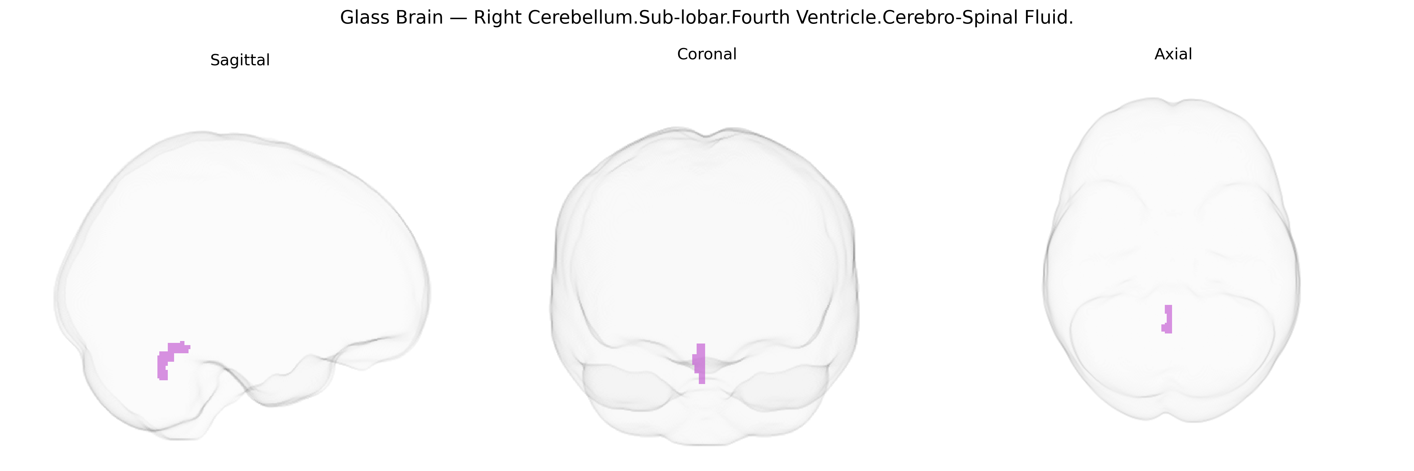 Triplanar Ghost Brain