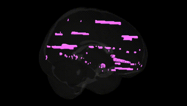 Full Brain Black